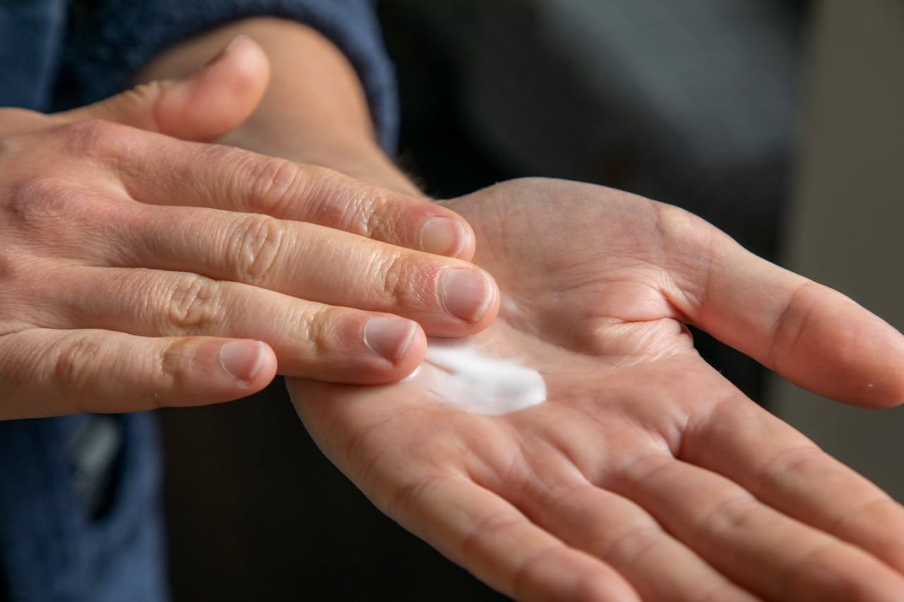 A person rubbing medicated lotion on their sweaty hands